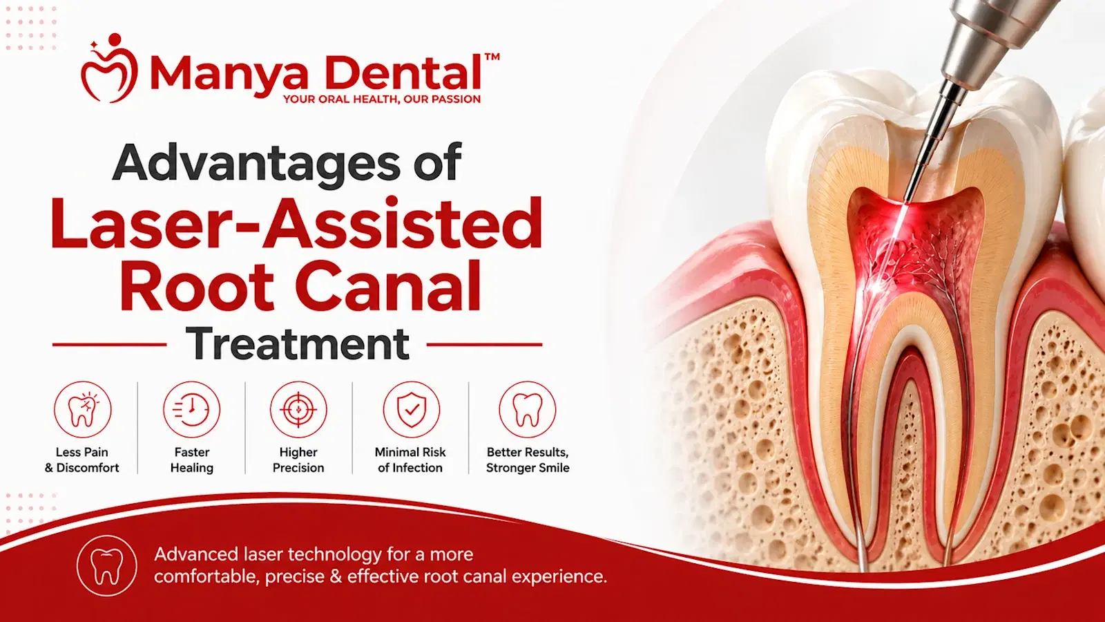 Laser Assisted Root Canal Treatment