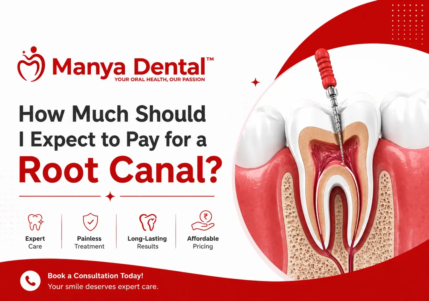 Root Canal Cost 1