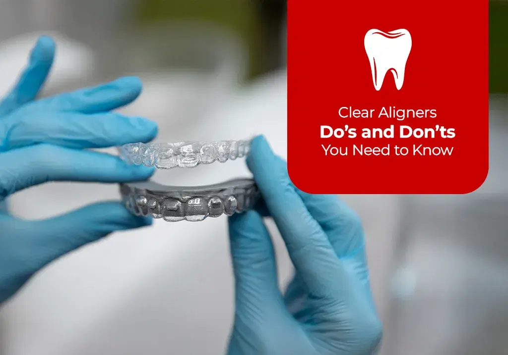 how-to-take-of-aligners