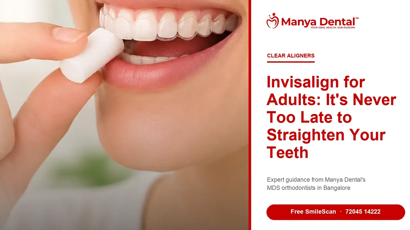 Invisalign for adults