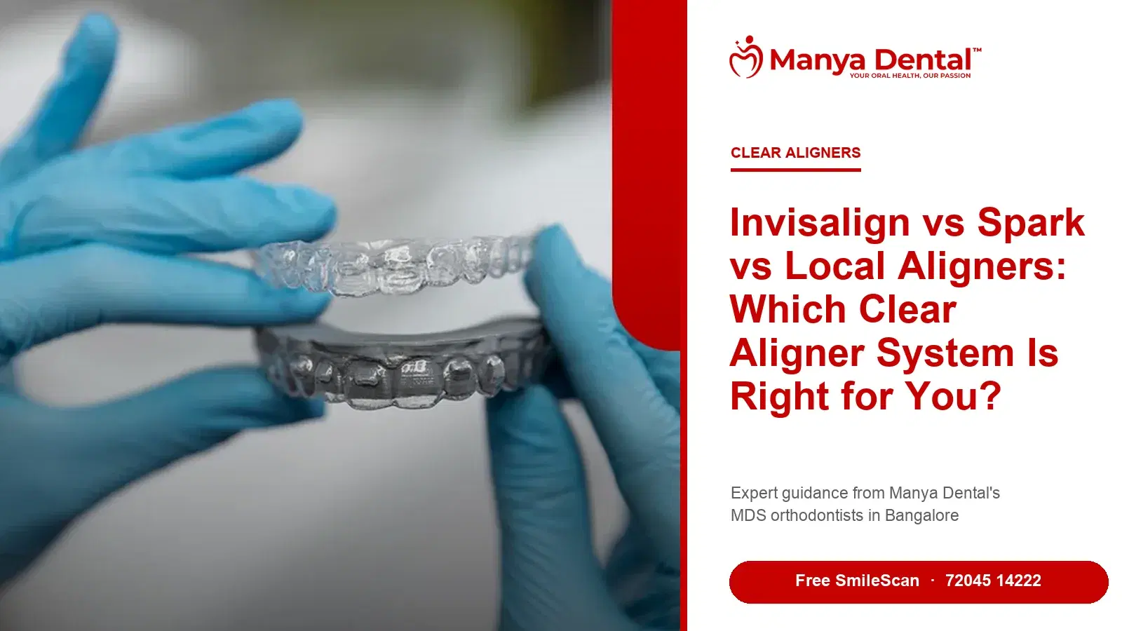 Invisalign vs Spark vs local aligners