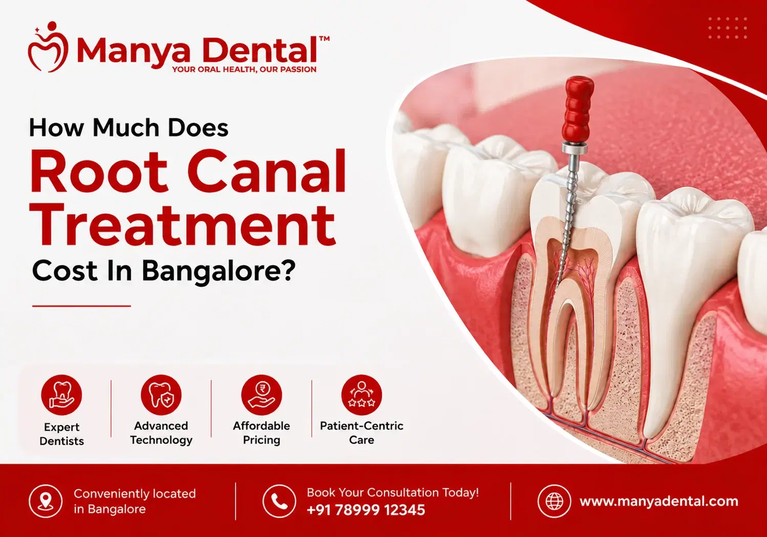 root can cost in bangalore