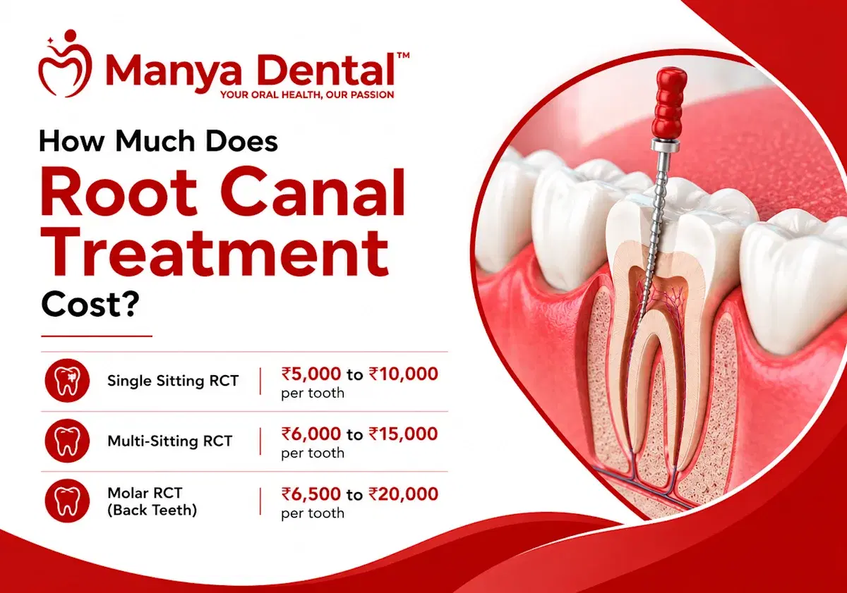 root can cost