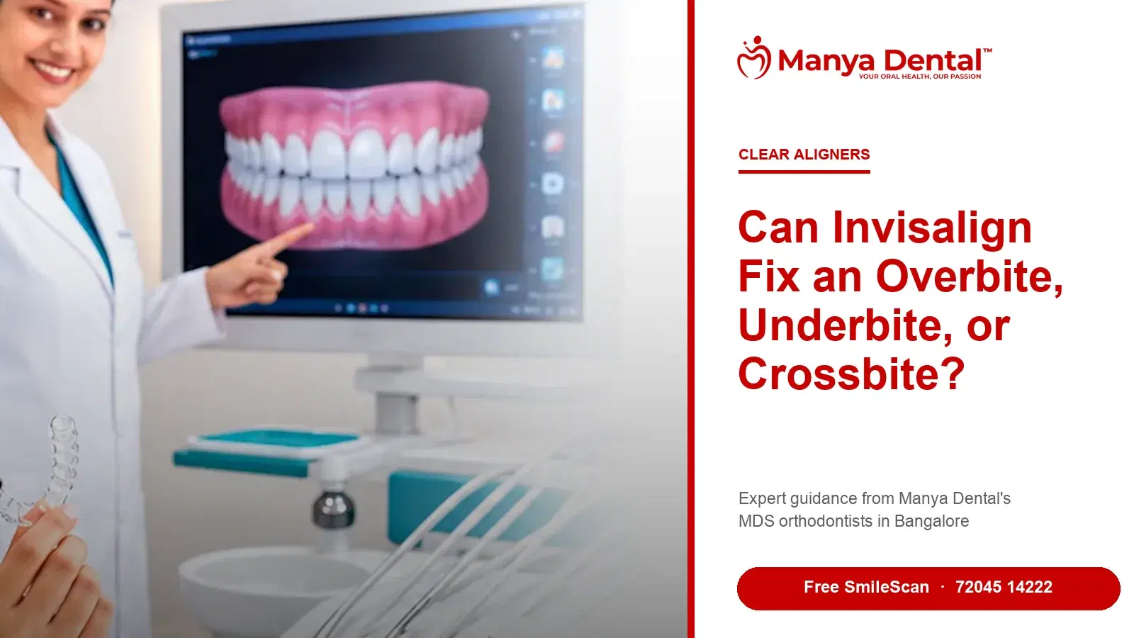 Invisalign for overbite, underbite and crossbite