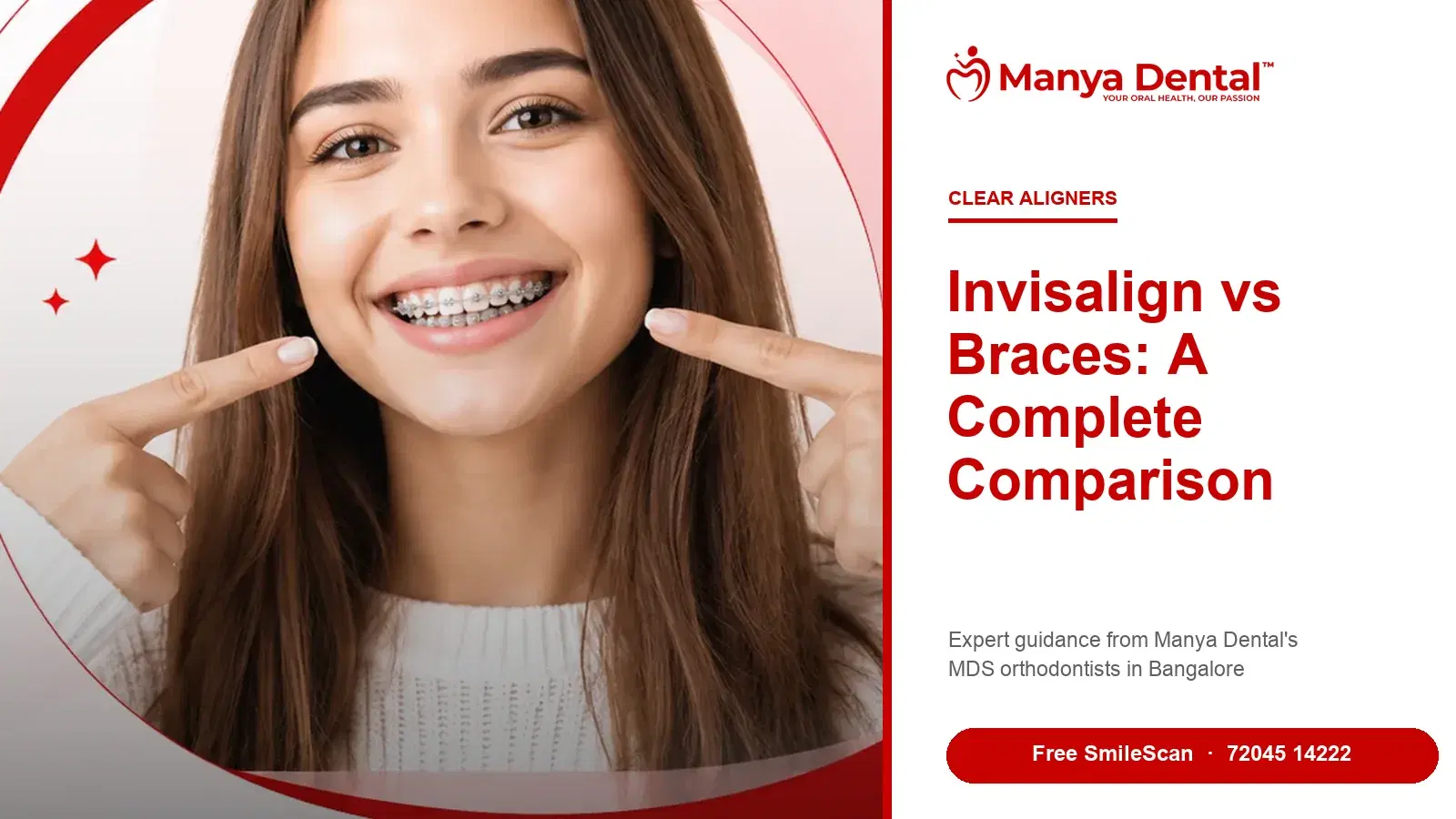 Invisalign vs braces comparison